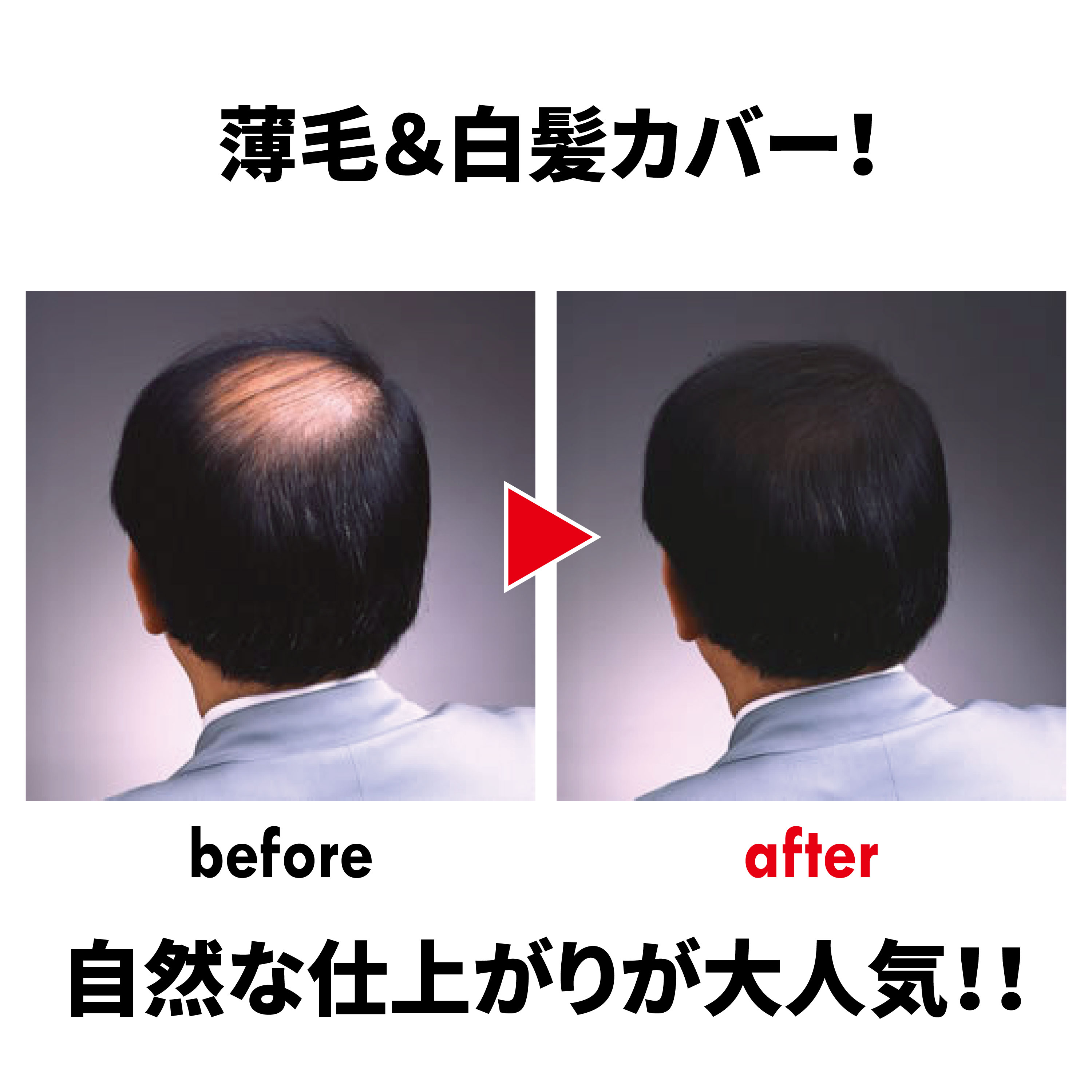 ﾜﾝﾀｯﾁｸﾞﾛｰEX  200g 2本【別送料1000円